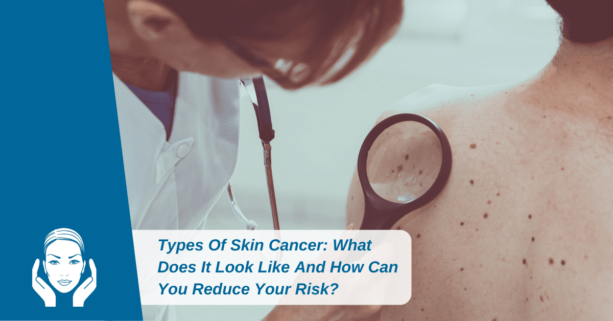 Types Of Skin Cancer & How Can You Reduce Your Risk?
